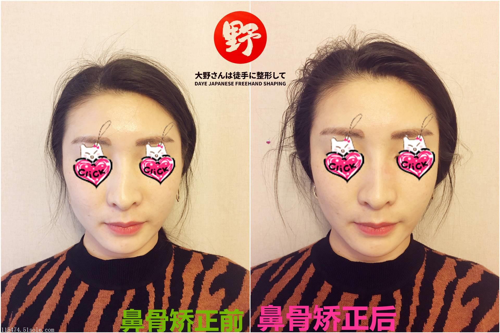 徒手整形培训 瘦脸 骨盆闭合 徒手私密