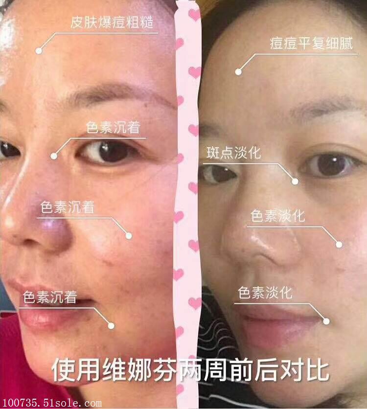 维娜芬护肤品多少钱,维娜芬是大牌吗,维娜芬怎么使用,总经销