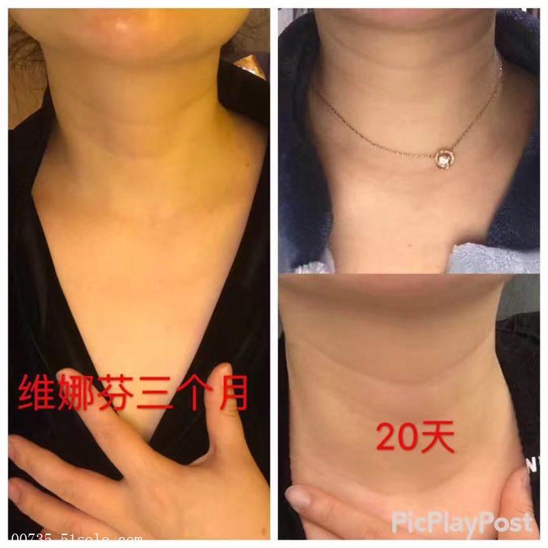 维娜芬,维娜芬护肤品怎么样,有人用过吗,总经销商小嫣
