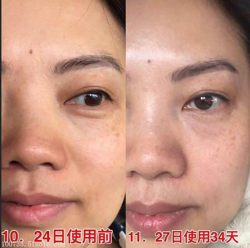 阳光家族,维娜芬总代小嫣,精华的主要成分有哪些,原理是什么