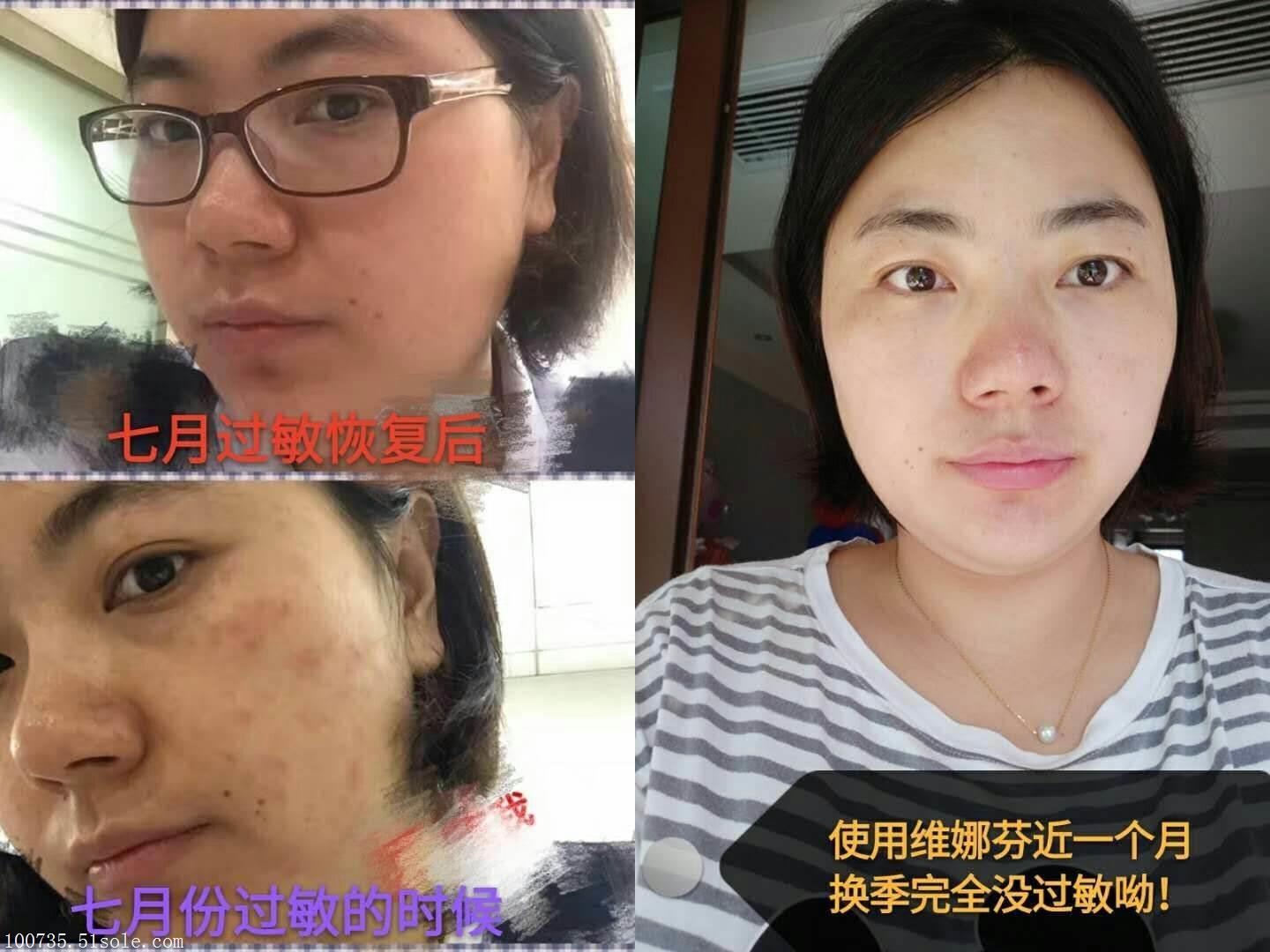 维娜芬效果为什么这么好,维娜芬是否含有激素,总经销商小嫣