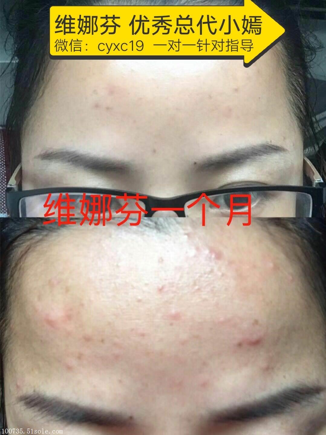 维娜芬阳光家族小嫣,为什么VNAWF紧致焕活精华可以有效抗皱吗