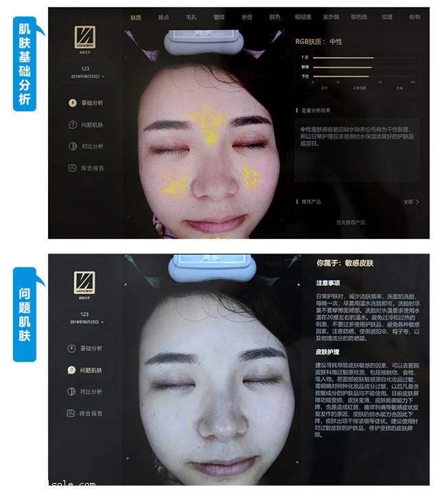 皮肤检测仪魔镜仪皮肤ct仪