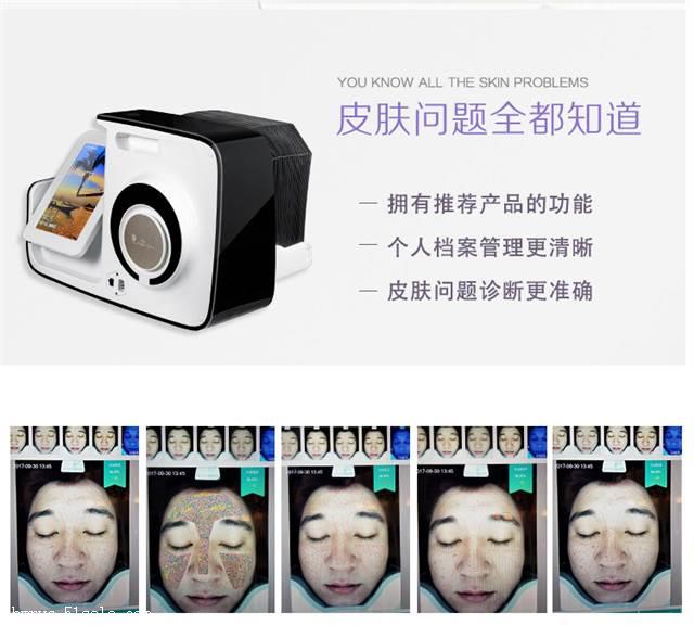 美容院专用皮肤检测仪皮肤检测ct机皮肤检测仪器多少钱一台