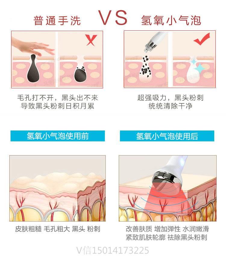 皮肤管理仪器韩国氢氧小气泡操作方法氢氧小气泡多少钱一台