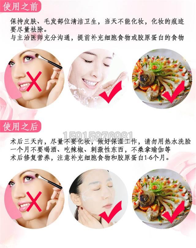 线雕用的线多少钱