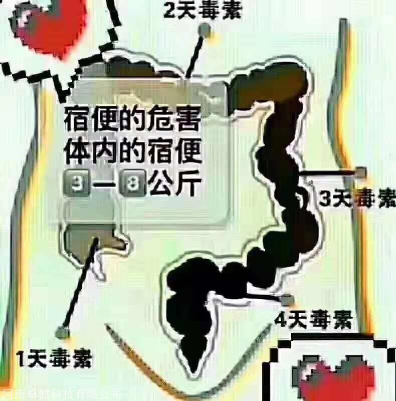 肠spa水疗仪厂家丨清肠排毒仪丨肠道水疗仪
