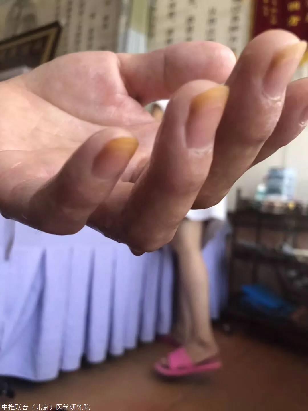 针灸推拿培训 魏朝军 魏氏一三组合针 秒杀疼痛,男妇科