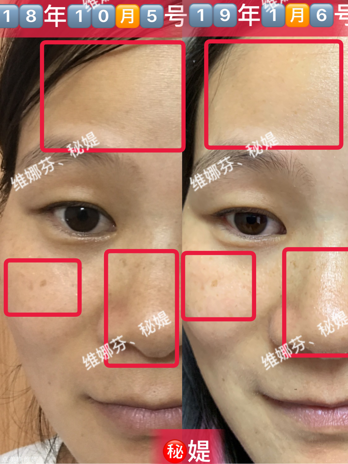 秘媞性价比高吗,秘媞有工厂和研发团队吗,总经销商小嫣