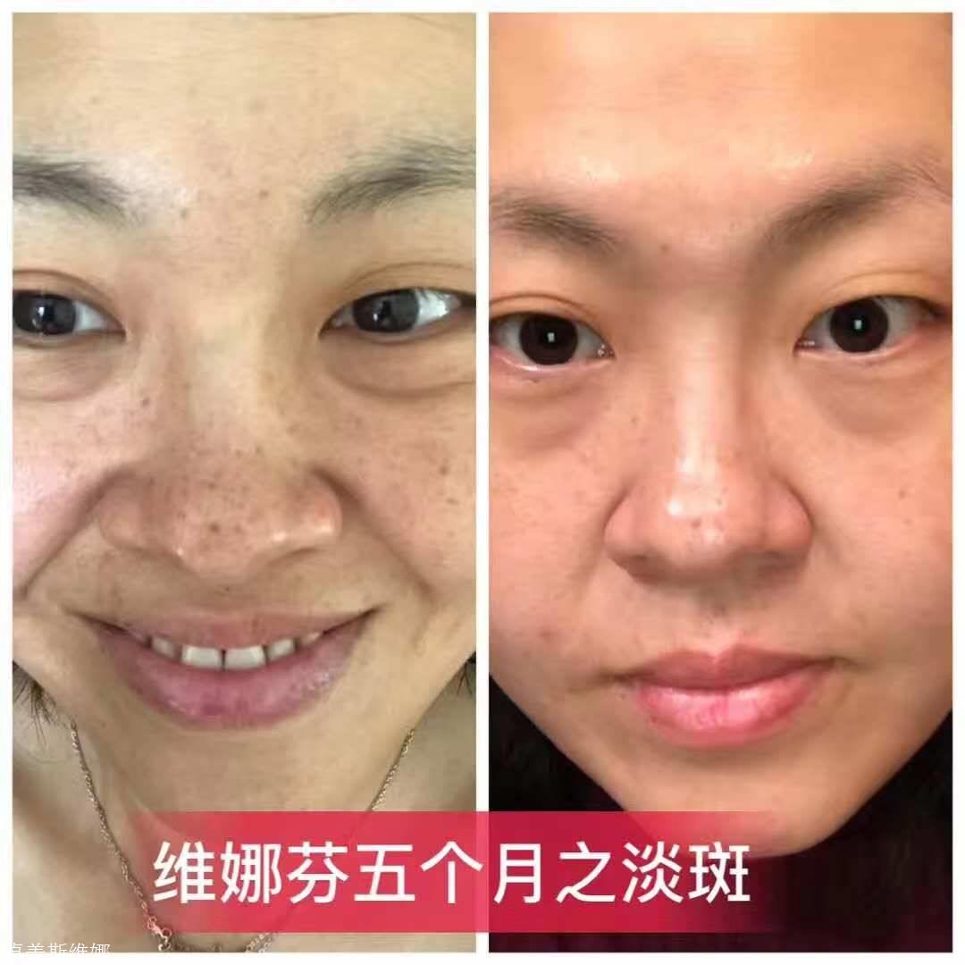 秘媞发布会,孕妈可以用秘媞吗,秘媞可以任意搭配用吗,小嫣