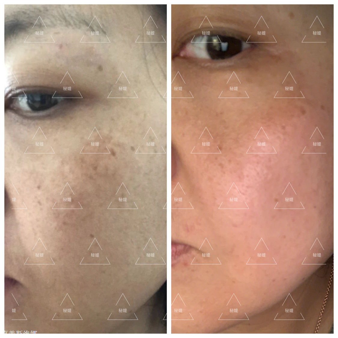 秘媞系列护肤品问题介绍,秘媞贵不贵,总经销商小嫣