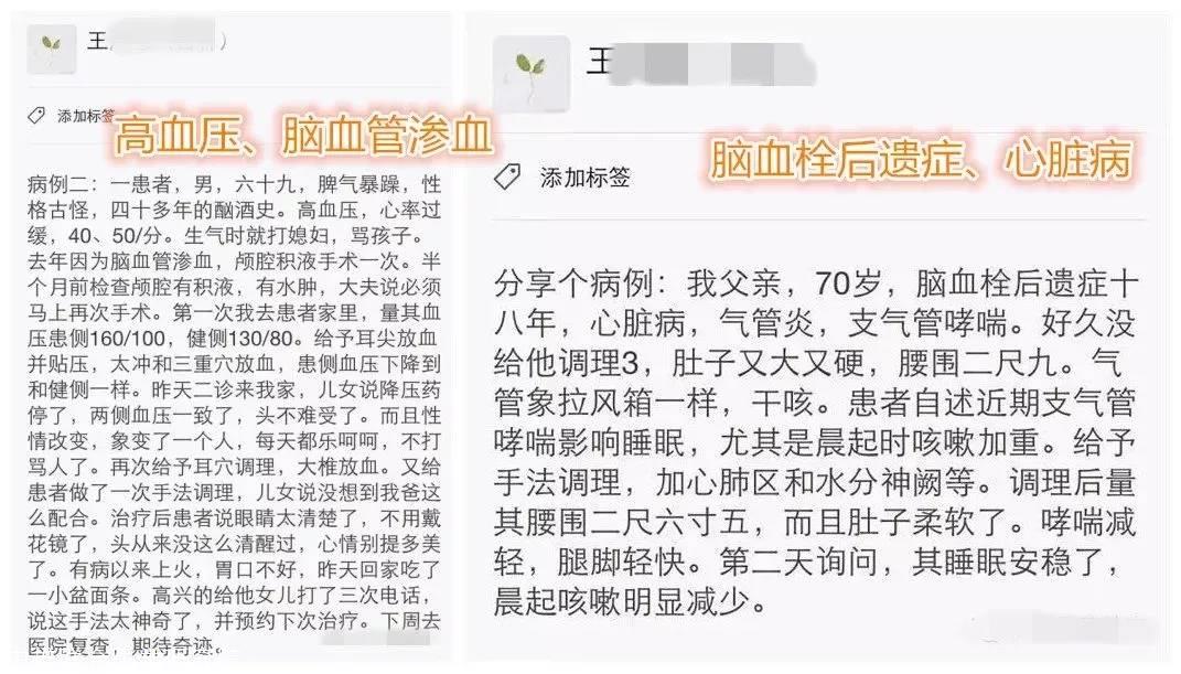 揭秘肛疗根骶手法从肛门入手牵一发而动全身