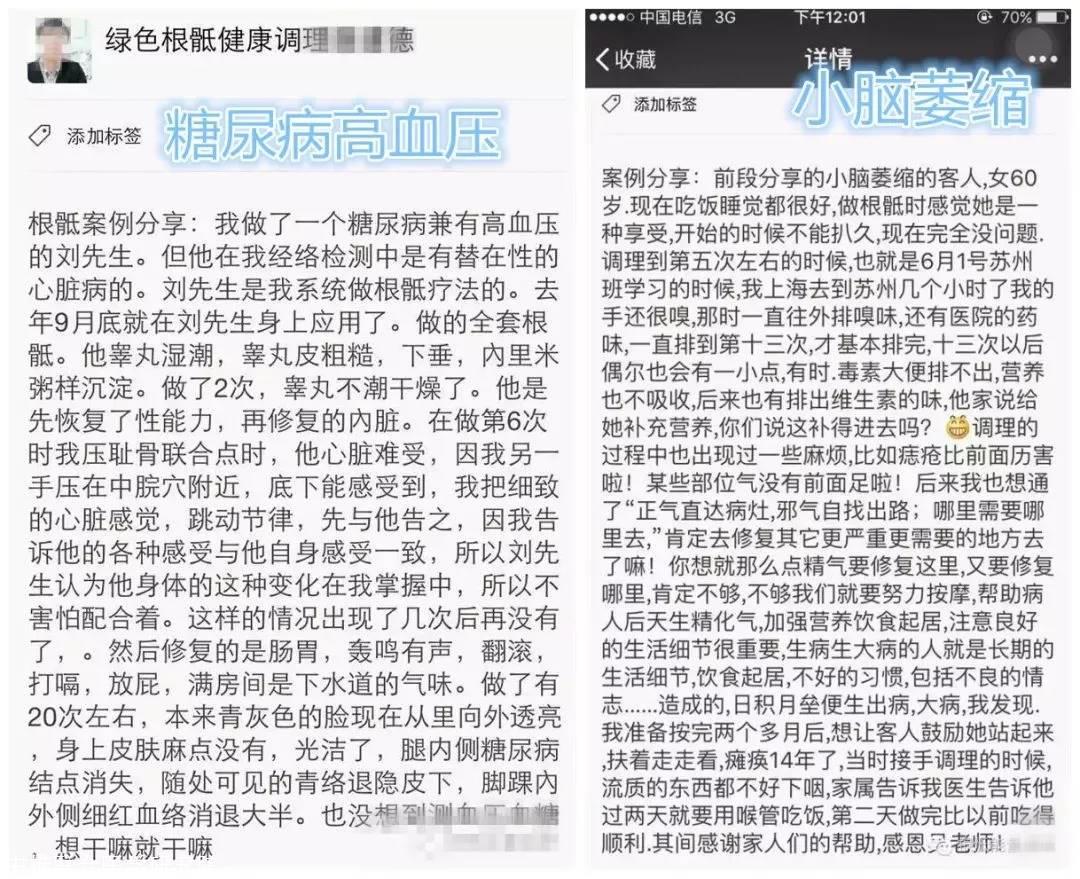 揭秘肛疗根骶手法--从肛门入手,牵一发而动全身