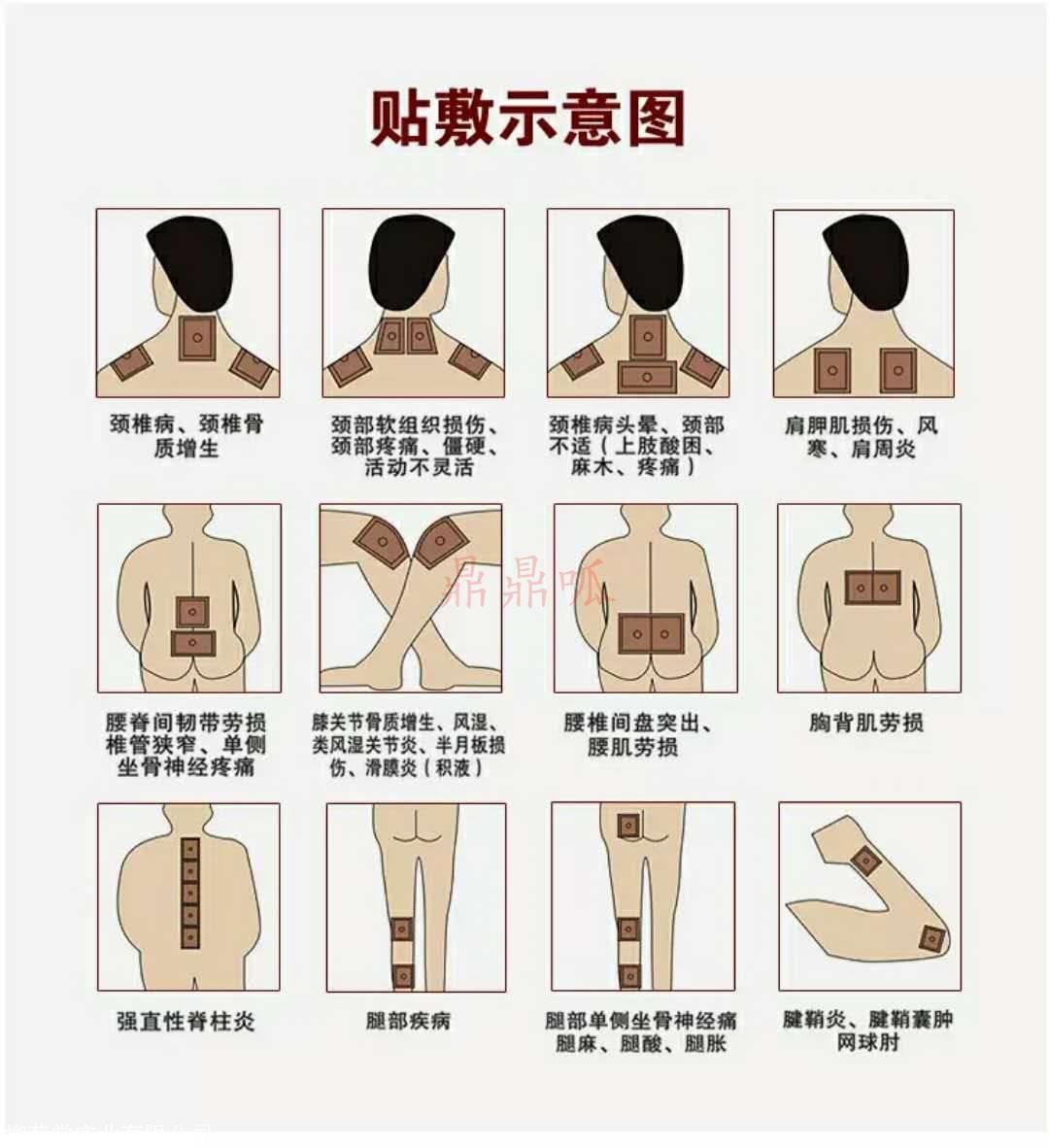 鼎方筋骨贴多少钱 正规网站正规产品真实报道