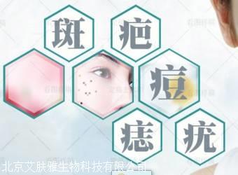 冷冻祛斑加盟合同样板生物酶祛斑