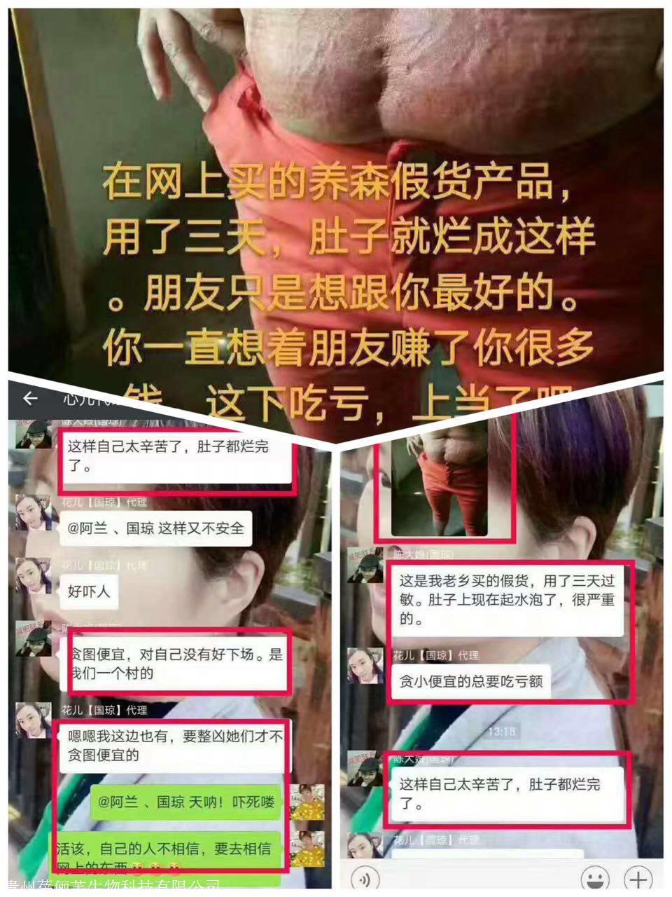 买前必看!养森瘦瘦包怎么验证真假?千万别贪便