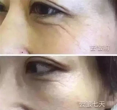 广州更靠谱信誉度好的化妆品加工企业拥有科研团队瘦脸原液oem