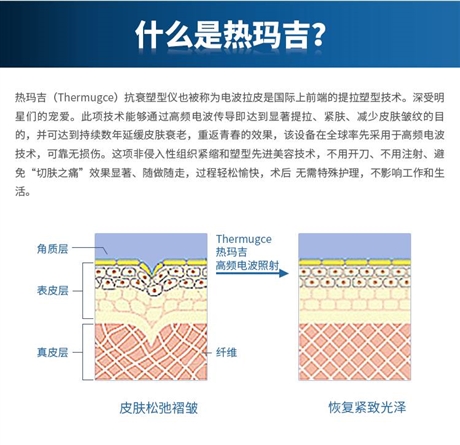 热玛吉五代10大品牌供应商 热玛吉5代原理及功效