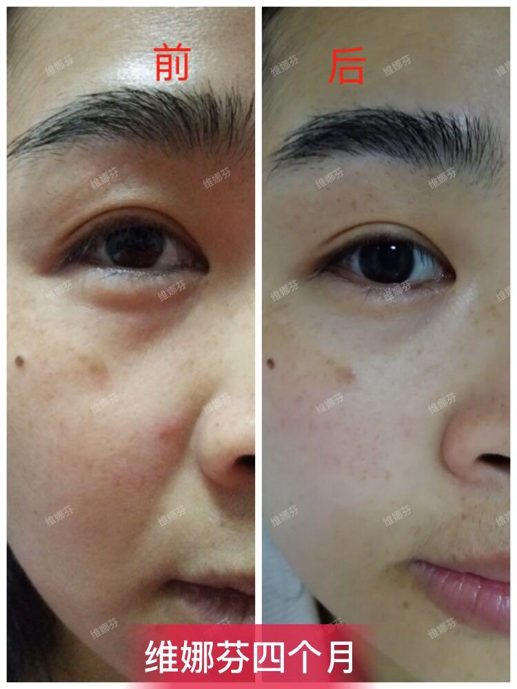 维娜芬化妆品怎么样 美白效果好