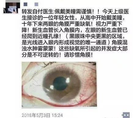 怎么才能买到正规美瞳,怎么才能买到正规美瞳呢