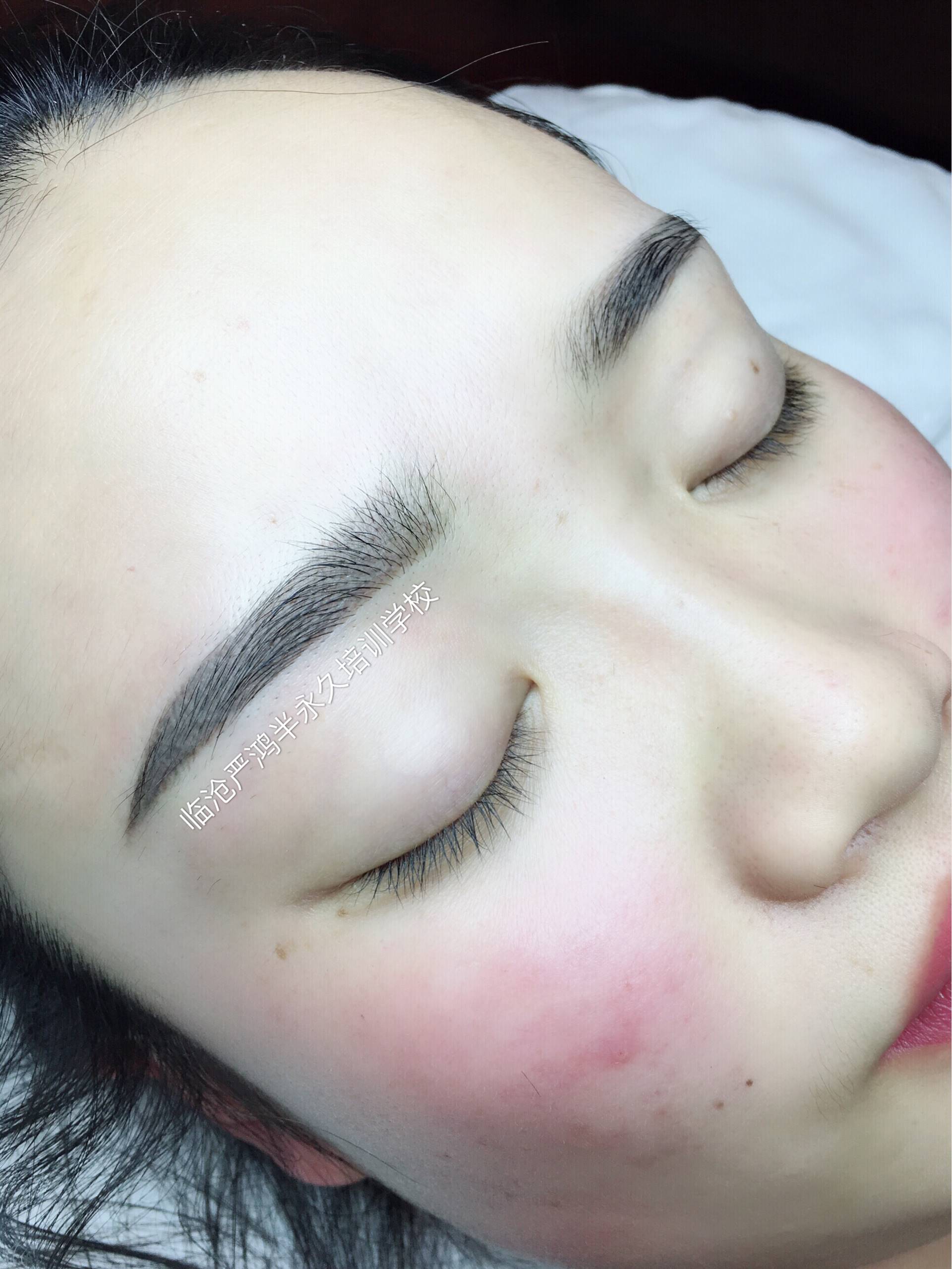 做了轻氧眉后几天能恢复自然