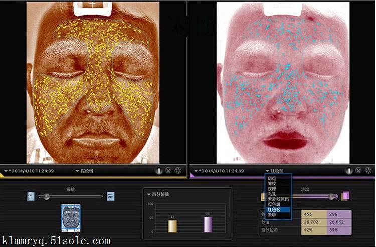 visia皮肤检测仪器图片皮肤测试仪真的有用吗