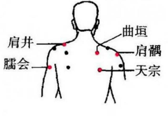治疗肩周炎常用穴【体会】治疗肩关节周围炎所取之穴,其穴理是:阳陵泉