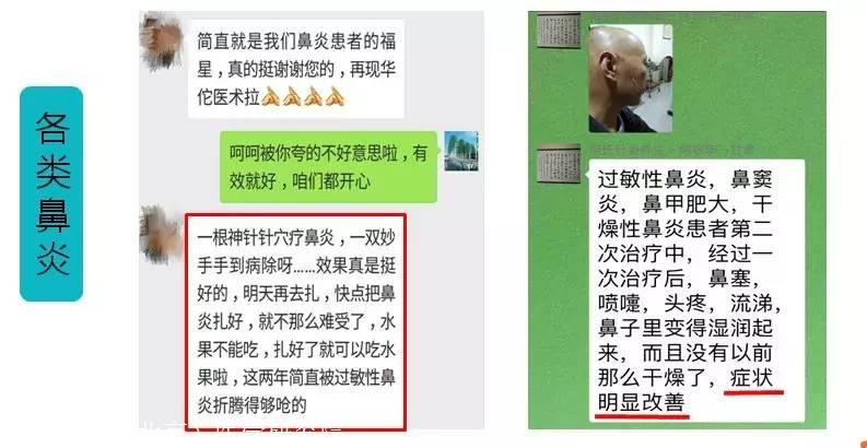 鼻炎可以买保险吗 鼻窦炎影响重疾险吗