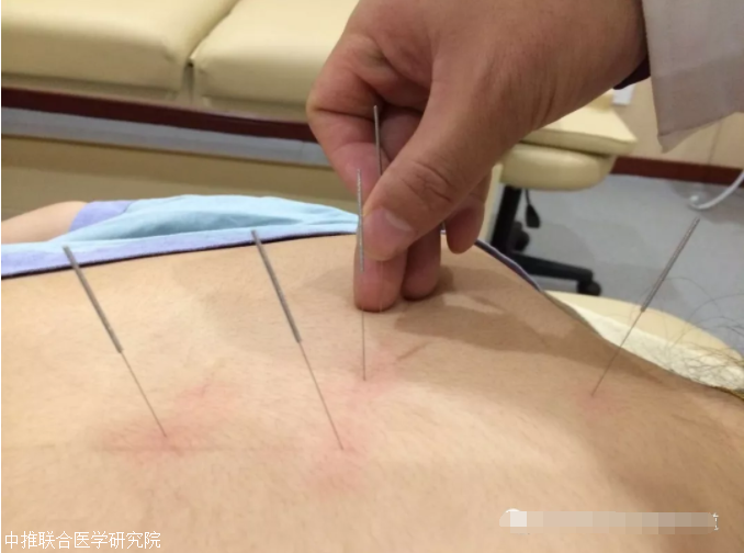 学针灸哪里好一针治疗膈肌痉挛