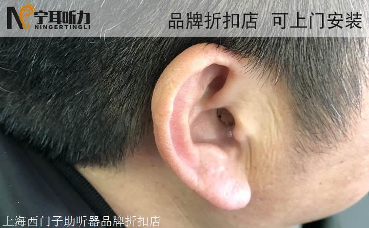 斯达克livioai助听器迷你瑞克mric3122400价格宁耳打折