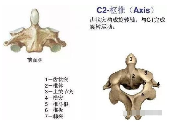 2,第二颈椎的特点第1颈椎又叫寰椎,它没有椎体和棘突,由前后弓和侧块