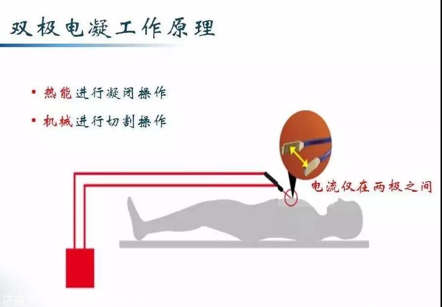 电刀的电凝和电切图解图片