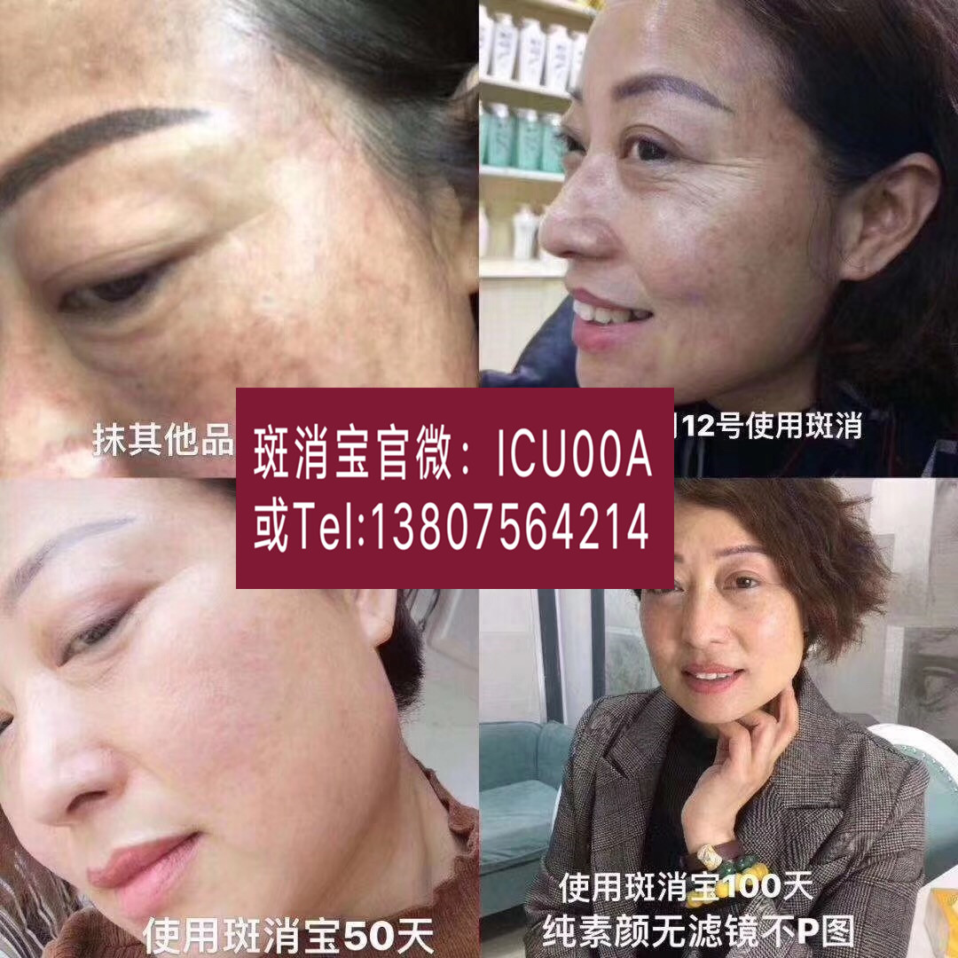 微商斑消宝,有产品责任险吗